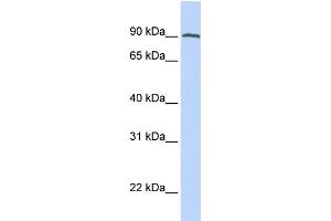 WB Suggested Anti-FOLH1 Antibody Titration:  0. (PSMA Antikörper  (C-Term))