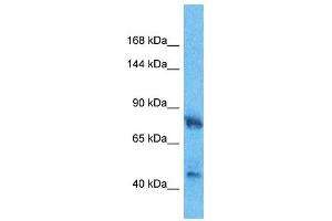 Host:  Rabbit  Target Name:  HMGCR  Sample Type:  Fetal Lung lysates  Antibody Dilution:  1. (HMGCR Antikörper  (C-Term))