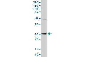 HPGD MaxPab polyclonal antibody. (HPGD Antikörper  (AA 1-266))