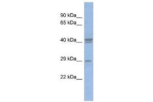 WB Suggested Anti-CEBPD  Antibody Titration: 0. (CEBPD Antikörper  (Middle Region))