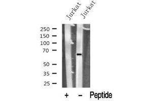 Western blot analysis of PNKP in lysates of Jurkat? (PNKP Antikörper  (Internal Region))