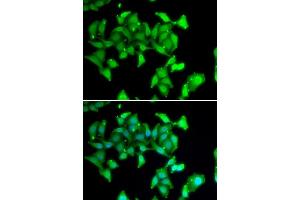Immunofluorescence analysis of MCF7 cells using MYO1C antibody. (Myosin IC Antikörper  (AA 769-1028))