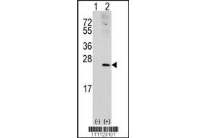 Western blot analysis of RAC1 using rabbit polyclonal RAC1 Antibody (S71). (RAC1 Antikörper  (AA 49-78))