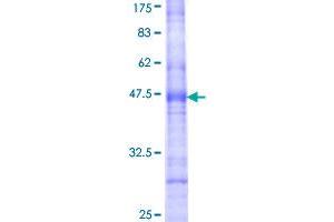 CDS1 Protein (AA 1-98) (GST tag)