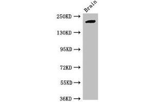 Western Blot Positive WB detected in: Mouse brain tissue All lanes: RBBP6 antibody at 2. (RBBP6 Antikörper  (AA 51-97))