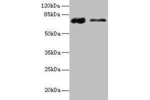 Western blot All lanes: GLCE antibody at 12 μg/mL Lane 1: Rat liver tissue Lane 2: Mouse kidney tissue Secondary Goat polyclonal to rabbit IgG at 1/10000 dilution Predicted band size: 71 kDa Observed band size: 71 kDa (GLCE Antikörper  (AA 29-617))