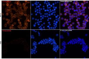 Immunofluorescence analysis of THP-1 and K562 cells using YKL-40/CHI3L1 Rabbit mAb (ABIN7266328) at dilution of 1:100 (40x lens). (CHI3L1 Antikörper)