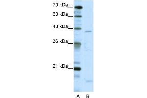 WB Suggested Anti-TRIAntibody Titration:  5. (TRIP13 Antikörper  (C-Term))