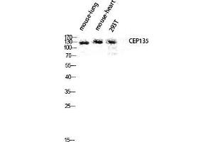 Western Blot (WB) analysis of Mouse Lung Mouse Heart 293T lysis using CEP135 antibody. (CEP135 Antikörper  (C-Term))
