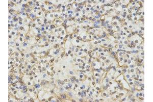 Immunohistochemistry (IHC) image for anti-Excision Repair Cross Complementing Polypeptide-1 (ERCC1) antibody (ABIN1876479) (ERCC1 Antikörper)