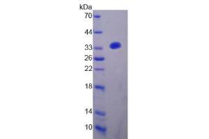 Image no. 1 for Cytochrome B-245, beta Polypeptide (CYBB) (AA 283-570) protein (His tag) (ABIN4989784)