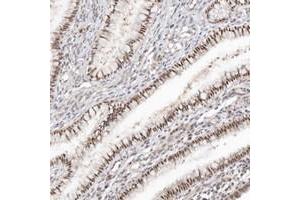 Immunohistochemical staining of human cervix, uterine, with LARP7 polyclonal antibody  shows nuclear positivity in glandular cells.