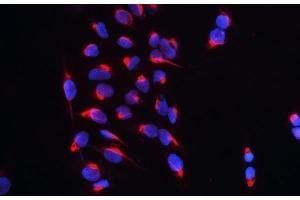 IF analysis of CARS using anti-CARS antibody (ABIN5692995) CARS was detected in immunocytochemical section of U20S cell.