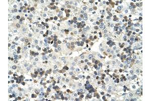 HSD17B6 antibody was used for immunohistochemistry at a concentration of 4-8 ug/ml to stain Hemopoietic cells (arrows) in Human Liver. (HSD17B6 Antikörper  (N-Term))