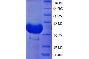 SDS-PAGE (SDS) image for Deiodinase, Iodothyronine, Type III (DIO3) (AA 37-278), (Extracellular) protein (His tag) (ABIN5710946)