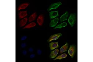 ABIN6264835 and ABIN6279045 staining Hela cells by IF/ICC. (RPL35A Antikörper  (N-Term))