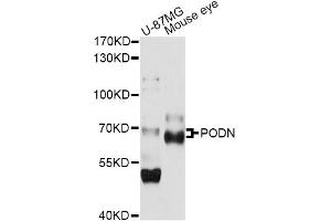 Western blot analysis of extracts of various cell lines, using PODN antibody (ABIN6290800) at 1:1000 dilution. (Podocan Antikörper)