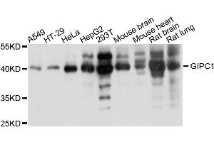 Western blot analysis of extracts of various cells, using GIPC1 antibody.