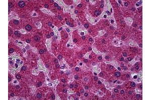 Anti-PPM1A antibody IHC of human liver. (PPM1A Antikörper  (AA 1-383))