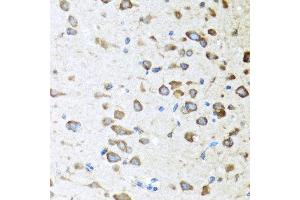 Immunohistochemistry of paraffin-embedded mouse brain using ACVR1C antibody at dilution of 1:100 (40x lens). (ACVR1C/ALK7 Antikörper)