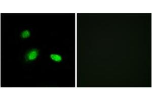 Immunofluorescence analysis of A549 cells, using HSPB2 Antibody. (HSPB2 Antikörper  (AA 121-170))