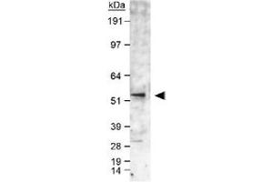 Western blot analysis of CYP19A1 in human fetal temporal lobe lysate using CYP19A1 polyclonal antibody . (Aromatase Antikörper  (AA 400-502))