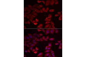 Immunofluorescence analysis of HeLa cell using SEPHS1 antibody. (SEPHS1 Antikörper)