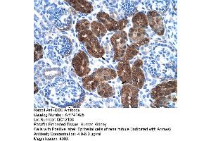 Rabbit Anti-DDC Antibody  Paraffin Embedded Tissue: Human Kidney Cellular Data: Epithelial cells of renal tubule Antibody Concentration: 4. (DDC Antikörper  (N-Term))
