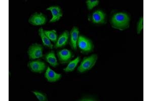 Immunofluorescence staining of A549 cells with ABIN7146237 at 1:133, counter-stained with DAPI. (Cadherin 7 Antikörper  (AA 146-296))