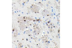 Immunohistochemistry of paraffin-embedded mouse brain using NMDA Rabbit mAb (ABIN7267420) at dilution of 1:100 (40x lens). (NMDAR2A Antikörper)