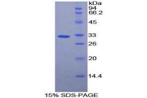 SDS-PAGE analysis of Rat Caspase 12 Protein. (Caspase 12 Protein)