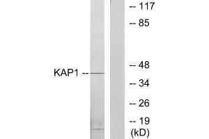 Western blot analysis of extracts from COLO205 cells, using KAP1 antibody.