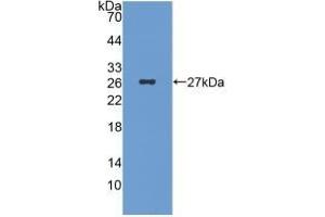Detection of Recombinant ICA1, Human using Monoclonal Antibody to Islet Cell Autoantigen 1 (ICA1) (ICA1 Antikörper  (AA 1-258))