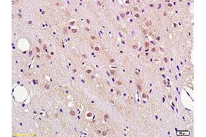 Formalin-fixed and paraffin embedded rat brain tissue labeled with Anti FBXW7/CDC4 Polyclonal Antibody, Unconjugated (ABIN1386103) at 1:200 followed by conjugation to the secondary antibody and DAB staining.
