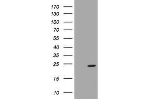 Image no. 1 for anti-Visinin-Like 1 (VSNL1) (AA 2-191) antibody (ABIN1491142) (VSNL1 Antikörper  (AA 2-191))