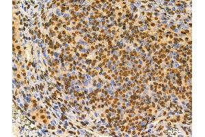 ABIN6257344 and ABIN6274221 at 1/100 staining Rat ovarian tissue by IHC-P. (MZF1 Antikörper  (N-Term))