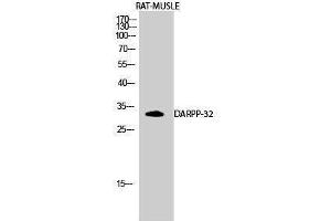 Western Blotting (WB) image for anti-Protein Phosphatase 1, Regulatory (Inhibitor) Subunit 1B (PPP1R1B) (Tyr785) antibody (ABIN3180011) (DARPP32 Antikörper  (Tyr785))