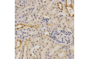 Immunohistochemistry (IHC) image for anti-Pyruvate Dehydrogenase (Lipoamide) alpha 1 (PDHA1) (AA 30-390) antibody (ABIN3023697)