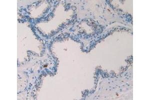 Detection of TPS in Human Prostate Gland Tissue using Monoclonal Antibody to Tryptase (TPS) (TPSAB1 Antikörper  (AA 161-262))