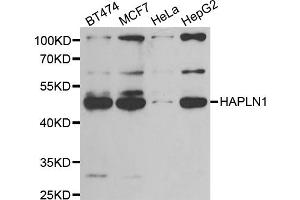 Western blot analysis of extracts of various cell lines, using HAPLN1 antibody. (HAPLN1 Antikörper)