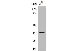 Western Blot analysis of K562 cells using CA VA Polyclonal Antibody (CA5A Antikörper  (Internal Region))