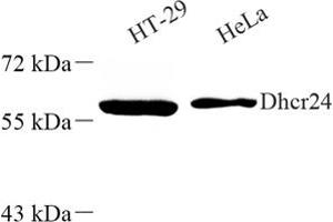 Western blot analysis of Dhcr24 (ABIN7072849) at dilution of 1: 500 (Seladin 1 Antikörper)