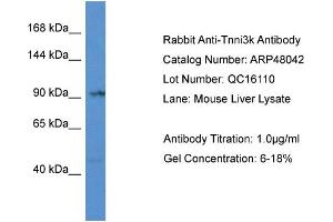 Western Blotting (WB) image for anti-TNNI3 Interacting Kinase (TNNI3K) (Middle Region) antibody (ABIN2783203) (TNNI3K Antikörper  (Middle Region))