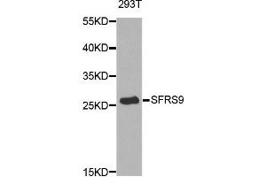 Western blot analysis of extracts of 293T cell line, using SFRS9 antibody. (SFRS9 Antikörper)