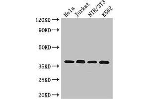 Western Blot Positive WB detected in: Hela whole cell lysate, Jurkat whole cell lysate, NIH/3T3 whole cell lysate, K562 whole cell lysate All lanes: RAD51 antibody at 2. (RAD51 Antikörper  (AA 1-228))