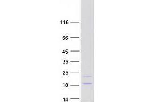 Western Blotting (WB) image for ATP synthase subunit delta, mitochondrial (ATP5F1D) (Transcript Variant 1) protein (Myc-DYKDDDDK Tag) (ABIN2715047)