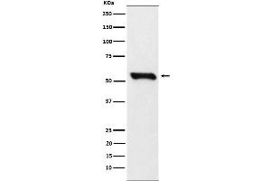 Western Blotting (WB) image for anti-Dihydrolipoamide Dehydrogenase (DLD) antibody (ABIN7606806)