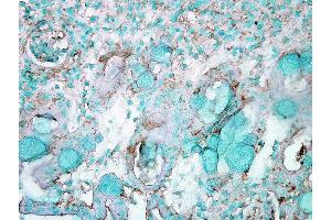 Immunohistochemistry analysis using Rabbit Anti-HSP70 Polyclonal Antibody .