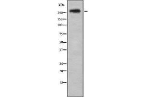 Western blot analysis SPTBN1 using HeLa whole cell lysates