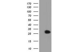 Western Blotting (WB) image for anti-Glutathione S-Transferase theta 2 (GSTT2) antibody (ABIN1498559) (GSTT2 Antikörper)